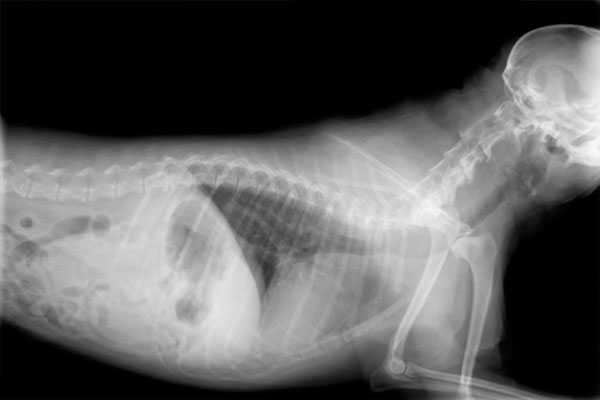X-ray of the chest