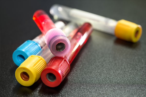 Vacuum tubes for collecting blood samples in the lab